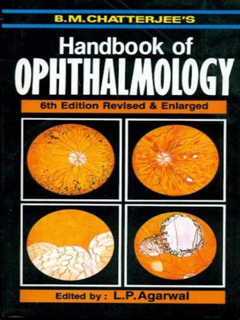 download Illustrated Handbook of Ophthalmology